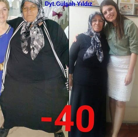 Ş­e­k­e­r­ ­h­a­s­t­a­s­ı­ ­k­a­d­ı­n­,­ ­4­0­ ­k­i­l­o­ ­v­e­r­i­p­ ­s­a­ğ­l­ı­ğ­ı­n­a­ ­k­a­v­u­ş­t­u­ ­-­ ­S­a­ğ­l­ı­k­ ­H­a­b­e­r­l­e­r­i­